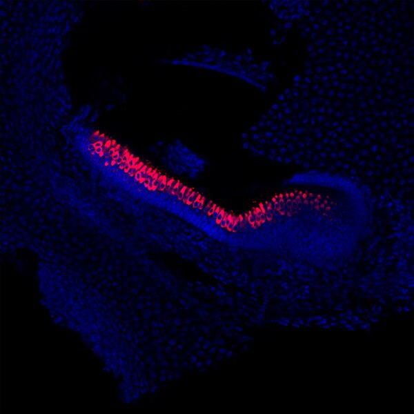 Confocal microscope image of mouse vestibular hair cells labeled with DSHB antibody Myo7A 138-1 (red). Image Credit: Karen Elliott Thompson